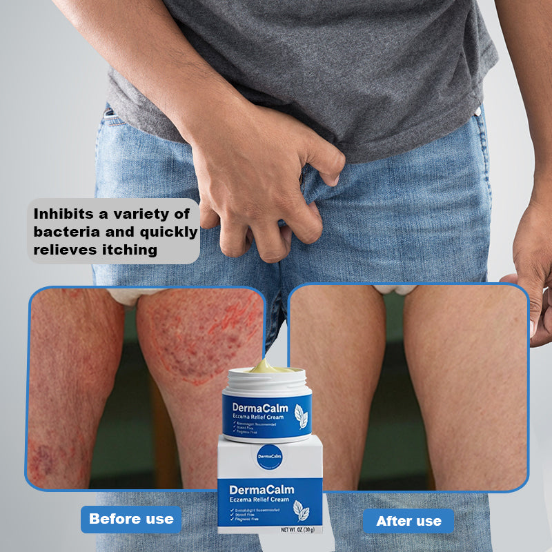 👍Official Store:DermaCalm Magnesium Herbal Intimate -Fast Relief for Psoriasis & Eczema&Itch relief|No-Rub, Steroid-Free,[Unisex]-Tax Free