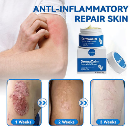 👍Official Store:DermaCalm Magnesium Herbal Intimate -Fast Relief for Psoriasis & Eczema|No-Rub, Steroid-Free,[Unisex]-Tax Free